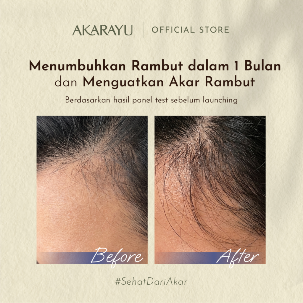 Before After - Strengthening - 2 (1) (2)