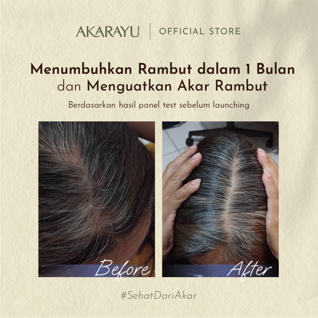Before After - Strengthening - 2 (2) (2)