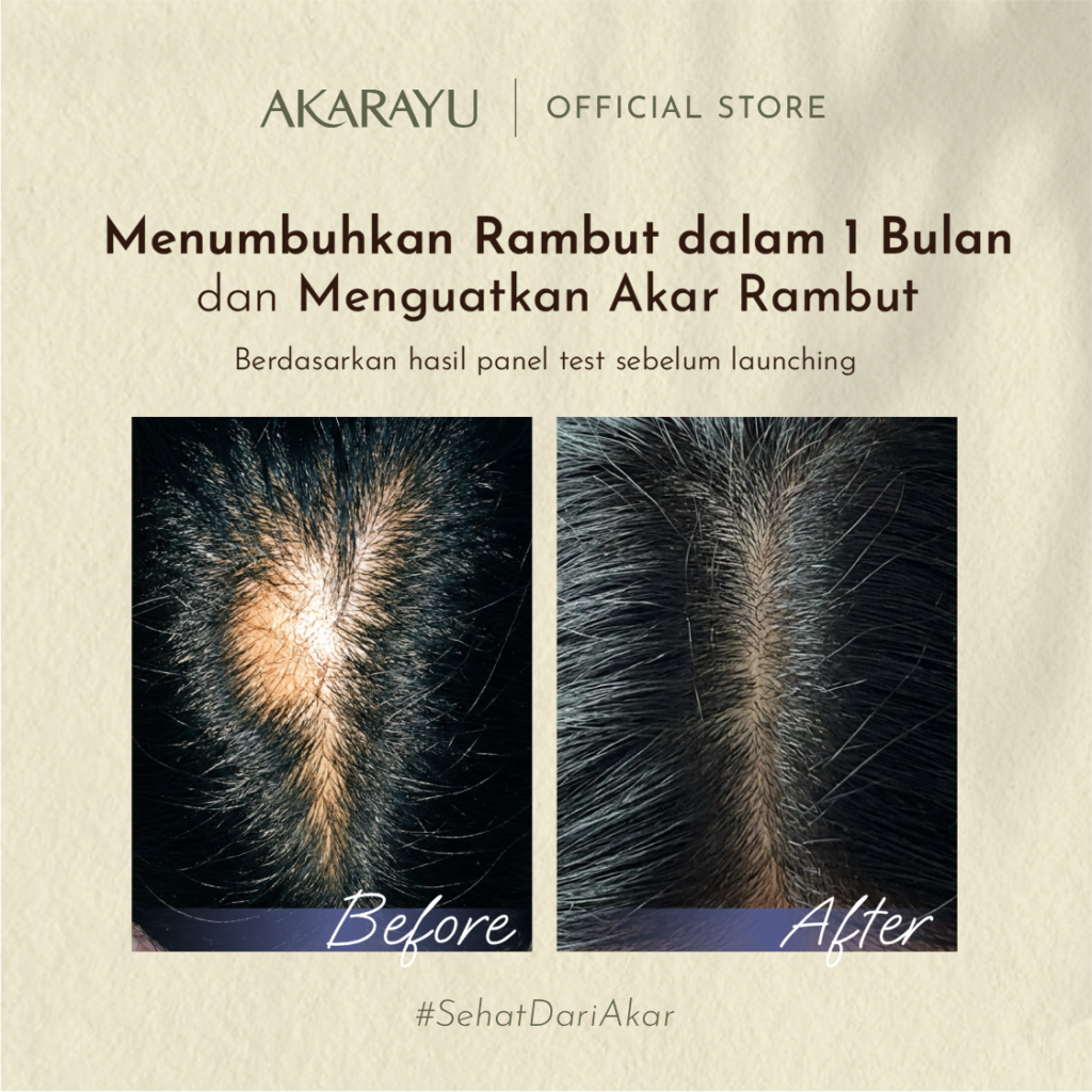 Before After - Strengthening - 2 (4)